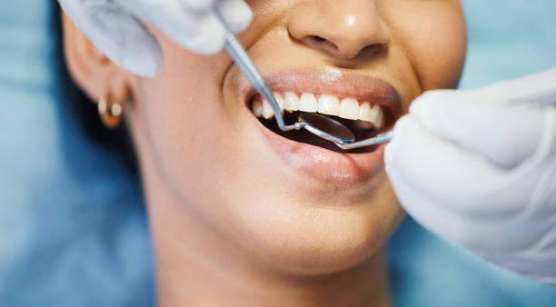 Best Broken or Cracked Tooth Emergency Dentist in Breckenridge, CO